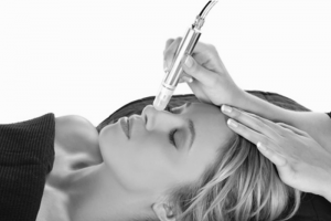 Microdermabrasion